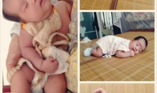 婴儿佝偻病睡姿图片